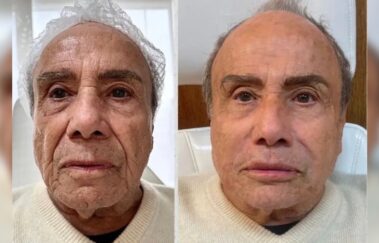 Mulher de Stênio Garcia nega relação entre harmonização e quadro de infecção generalizada