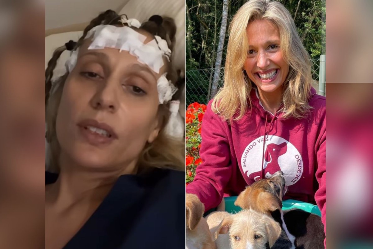Apresentadora e ativista da causa animal Luisa Mell foi internada após ter uma convulsão (Reprodução/ Redes sociais)