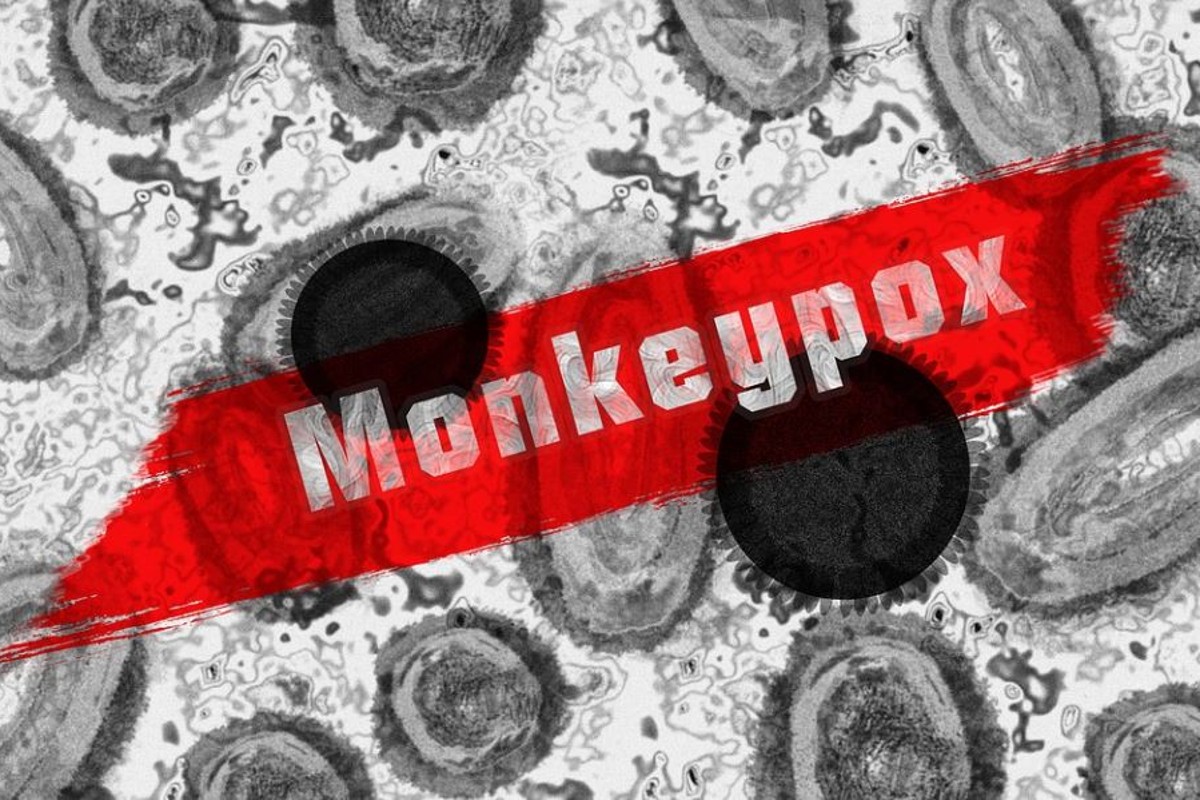 Monkeypox foi descoberto pela primeira vez em 1958, quando dois surtos de uma doença semelhante à varíola ocorreram em colônias de macacos mantidos para pesquisa (Foto: Pixabay)