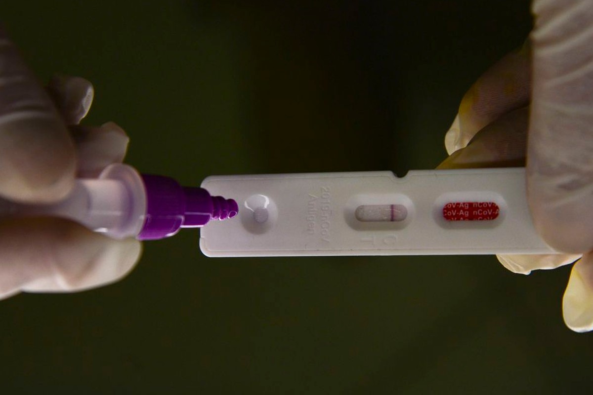 Pacientes infectados pela Covid tiveram variações na concentração de seis substâncias encontradas no sangue (Foto: Marcello Casal Jr/ Agência Brasil)